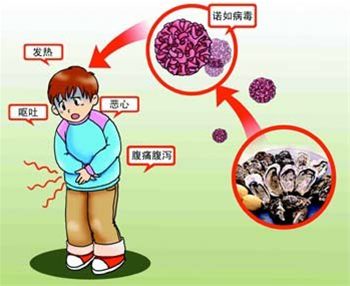 冬季警惕诺如病毒爆发 平安急性肠胃炎健康保险可保障